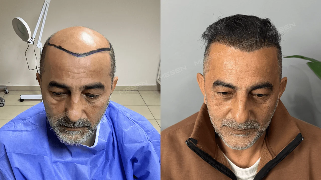 Solda geniş açık üst bölge üzerinde koyu planlama çizgisi, sağda geriye taranmış kır ve koyu saçlar.