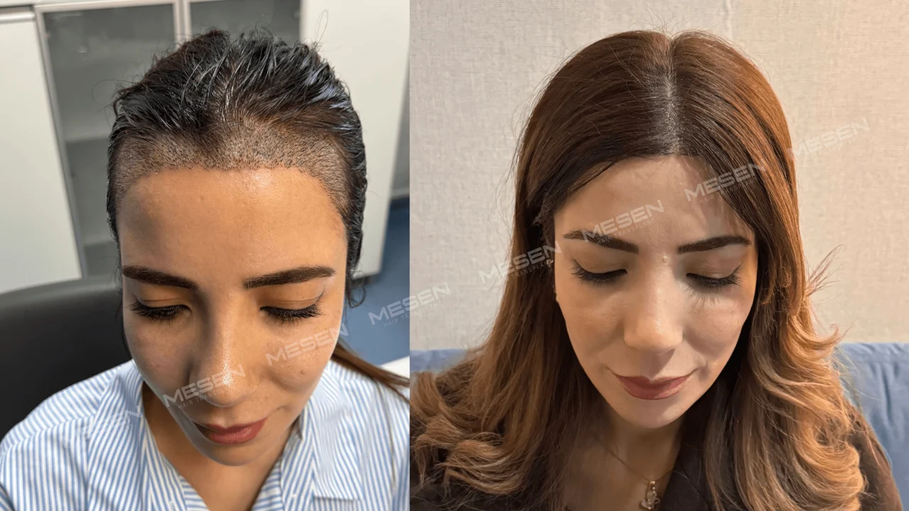 Solda geriye taranmış koyu saçlarla açık görünen şakaklar, sağda ortadan ayrılmış omuz hizasında saçlarla ön çizgi.